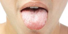 أسباب جفاف الفم والعطش
