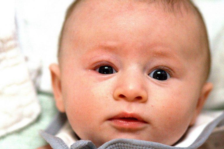 احمرار جفن العين عند الأطفال الرضع • معرفة